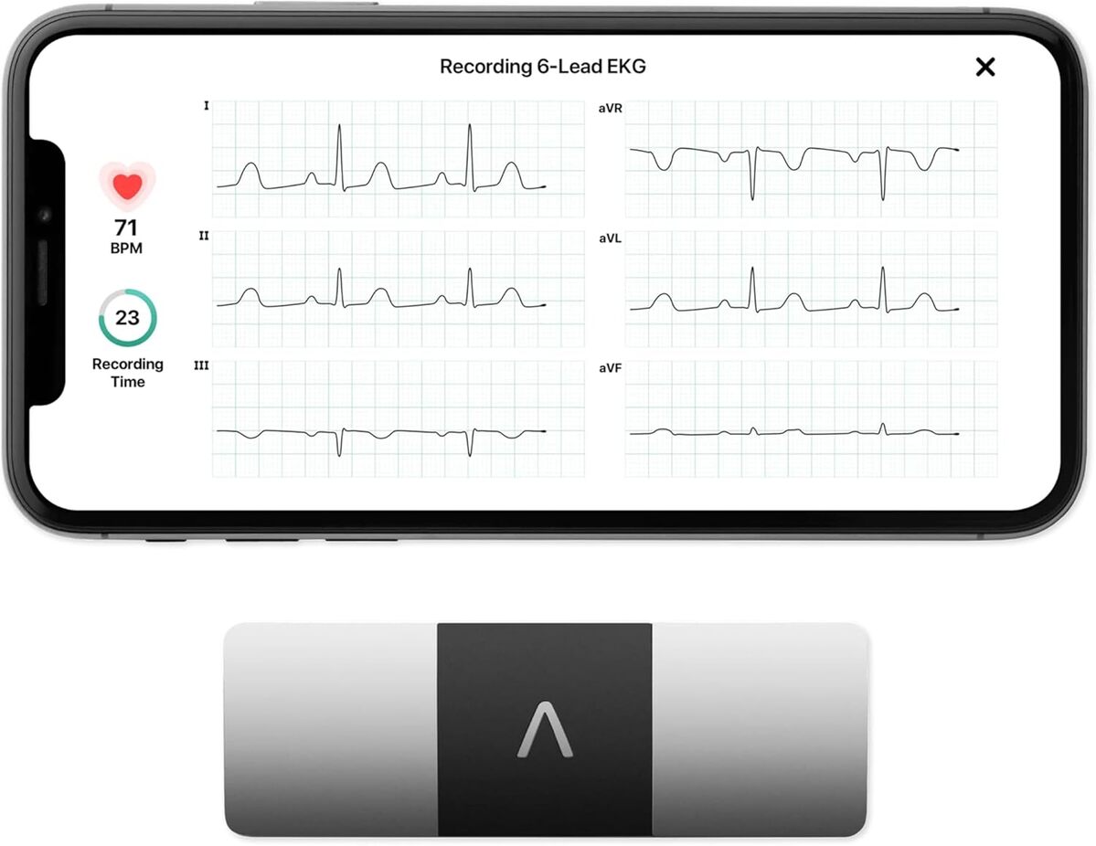 Test du KardiaMobile 6L : l'ECG connecté de AliveCor ultra-portable